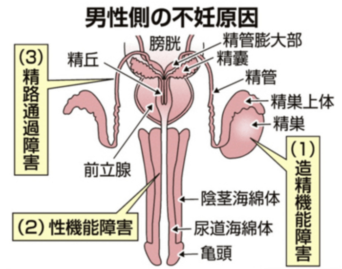 ４．男性側の不妊原因