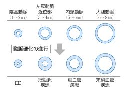 血管サイズ